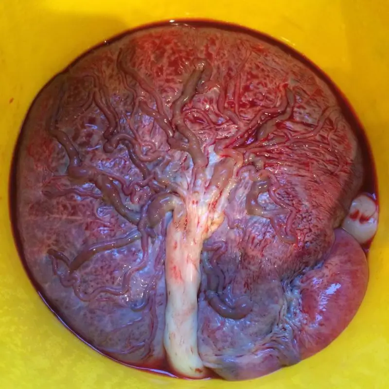 How and why I consumed my placenta